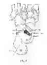 Fig. 08 - Sperical subtalar implant