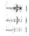 Fig. 02 - Percutaneous osseointegrated implant assembly for use in supporting an exo-prosthesis