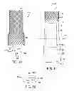 Fig. 09 - Multi valve anti-reflux prosthesis