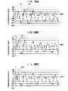 Fig. 34 - INPUT DEVICE AND METHOD AND PROGRAM