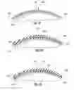 Fig. 16 - Basketball sensing apparatus