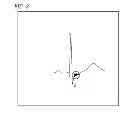 Fig. 03 - Biological signal averaging processing device