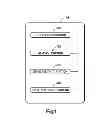 Fig. 02 - Method for designing and manufacturing a bone implant