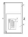 Fig. 05 - Method for designing and manufacturing a bone implant