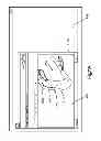 Fig. 12 - Method for designing and manufacturing a bone implant