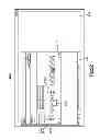 Fig. 24 - Method for designing and manufacturing a bone implant