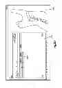 Fig. 25 - Method for designing and manufacturing a bone implant