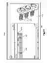 Fig. 26 - Method for designing and manufacturing a bone implant