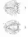 Fig. 02 - Vocal fold movement translation device and method of using same