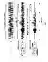 Fig. 150 - Method and apparatus for signal filtering and for improving properties of electronic devices