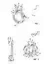 Fig. 02 - Interchangeable jewelry setting system