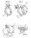 Fig. 05 - Interchangeable jewelry setting system