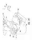 Fig. 10 - Needle bending apparatus and methods