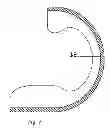 Fig. 08 - Method and Device for Protection of Musical Instruments
