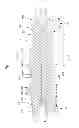 Fig. 05 - Pressure roller for an apparatus for compaction of empty beverage containers