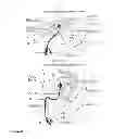 Fig. 09 - Pressure release means and placement indicator for inflatable catheter or respiratory gas supply retention means