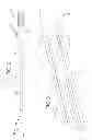 Fig. 03 - Bridle delivery system, method, and apparatus for securing nasal tubes