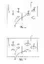 Fig. 09 - TRACHEAL DILATION APPARATUS AND METHOD OF MANUFACTURE