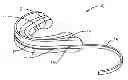 Fig. 01 - Mouthguard assembly