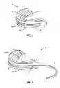 Fig. 02 - Mouthguard assembly