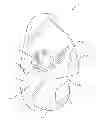 Fig. 01 - INTEGRAL MOUTHGUARD OXYGEN MASK