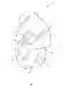 Fig. 03 - INTEGRAL MOUTHGUARD OXYGEN MASK