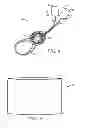 Fig. 04 - Corded hearing protective device and method of manufacturing the same
