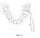 Fig. 09 - Interdental cleaning device