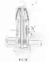 Fig. 10 - Interdental cleaning device