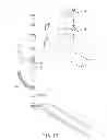 Fig. 13 - Interdental cleaning device