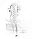 Fig. 14 - Interdental cleaning device