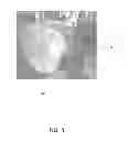 Fig. 04 - PROTECTIVE DEVICES AND METHODS FOR PRECISION APPLICATION OF CLEANING POLYMER TO OPTICS