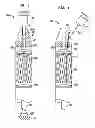 Fig. 04 - Preparation methods for transcatheter heart valve delivery systems