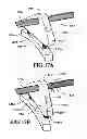 Fig. 15 - Sleeve valve with sync cam