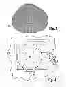 Fig. 04 - Method and system of vacuum assisted resin transfer moldings for repair of composite materials and structure