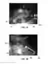 Fig. 06 - DIGESTER WITH IMPROVED VAPOR CONTROL