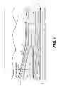 Fig. 02 - Method and System for Monitoring The Incursion of Particulate Material into A Well Casing within Hydrocarbon Bearing Formations including Gas Hydrates