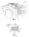 Fig. 09 - Downhole anchoring systems and methods of using same