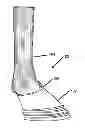 Fig. 01 - HOOF COVER