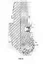 Fig. 11 - HIGH SHEAR ROLLER CONE DRILL BITS