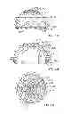 Fig. 14 - HIGH SHEAR ROLLER CONE DRILL BITS