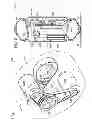 Fig. 05 - Electric-powered self-balancing unicycle with steering linkage between handlebars and wheel forks