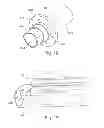 Fig. 11 - Bicycle frame, battery pack, and bicycle