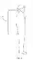 Fig. 04 - Tree Climbing Device And Stand