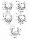 Fig. 09 - Upright protector