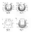 Fig. 13 - Upright protector