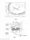 Fig. 05 - Apparatus and method for density separator for drilling fluid