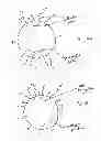 Fig. 17 - Method and system for releasing mineral from synthetic bubbles and beads