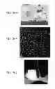 Fig. 45 - Water treatment systems and methods