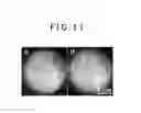 Fig. 12 - ELECTRON MICROSCOPE AND SAMPLE OBSERVATION METHOD